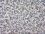 DHFR Antibody in Immunohistochemistry (Paraffin) (IHC (P))