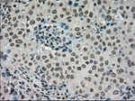DHFR Antibody in Immunohistochemistry (Paraffin) (IHC (P))