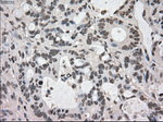 DHFR Antibody in Immunohistochemistry (Paraffin) (IHC (P))