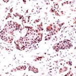 DHFR Antibody in Immunohistochemistry (IHC)
