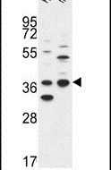 DHRS3 Antibody in Western Blot (WB)