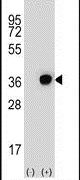 DHRS3 Antibody in Western Blot (WB)