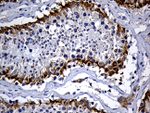 DHRS4L2 Antibody in Immunohistochemistry (Paraffin) (IHC (P))