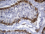 DHRS4L2 Antibody in Immunohistochemistry (Paraffin) (IHC (P))