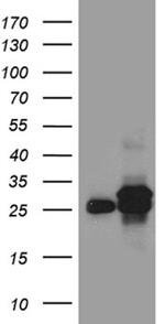 DHRS4L2 Antibody in Western Blot (WB)