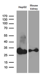 DHRS4L2 Antibody in Western Blot (WB)