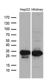 DHRS4L2 Antibody in Western Blot (WB)