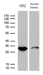 DHRS4L2 Antibody in Western Blot (WB)