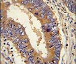 LGP2 Antibody in Immunohistochemistry (IHC)