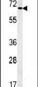 LGP2 Antibody in Western Blot (WB)