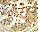 DIAPH2 Antibody in Immunohistochemistry (IHC)