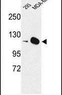 DIAPH2 Antibody in Western Blot (WB)