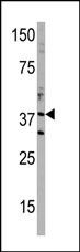 DIMT1 Antibody in Western Blot (WB)