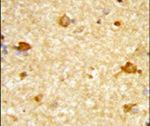 DIRAS1 Antibody in Immunohistochemistry (IHC)