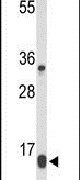 DIRAS1 Antibody in Western Blot (WB)