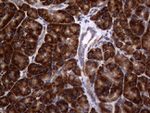 DIRAS2 Antibody in Immunohistochemistry (Paraffin) (IHC (P))
