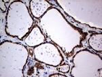 DIRAS2 Antibody in Immunohistochemistry (Paraffin) (IHC (P))