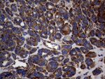 DIRAS2 Antibody in Immunohistochemistry (Paraffin) (IHC (P))