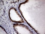 DIRAS2 Antibody in Immunohistochemistry (Paraffin) (IHC (P))