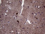 DIRAS2 Antibody in Immunohistochemistry (Paraffin) (IHC (P))