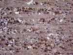 DIRAS2 Antibody in Immunohistochemistry (Paraffin) (IHC (P))
