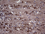 DIRAS2 Antibody in Immunohistochemistry (Paraffin) (IHC (P))