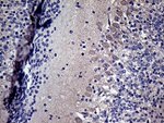 DIRAS2 Antibody in Immunohistochemistry (Paraffin) (IHC (P))
