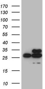 DIRAS2 Antibody in Western Blot (WB)