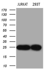 DIRAS2 Antibody in Western Blot (WB)