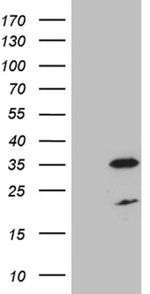 DIRAS2 Antibody in Western Blot (WB)