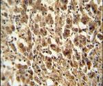 DIS3 Antibody in Immunohistochemistry (IHC)