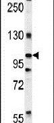 DIS3 Antibody in Western Blot (WB)
