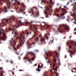 DJ-1 Antibody in Immunohistochemistry (IHC)