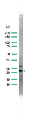 DJ-1 Antibody in Western Blot (WB)