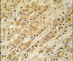 DKC1 Antibody in Immunohistochemistry (IHC)
