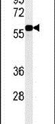 DKC1 Antibody in Western Blot (WB)