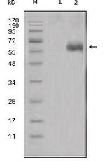 DKK1 Monoclonal Antibody (2H2)