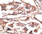 DKK2 Antibody in Immunohistochemistry (IHC)
