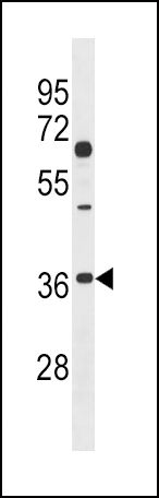 DKK2 Antibody in Western Blot (WB)