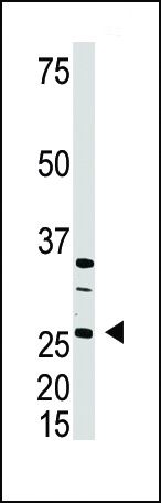 DKK4 Antibody in Western Blot (WB)