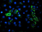 DLD Antibody in Immunocytochemistry (ICC/IF)