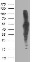 DLD Antibody in Western Blot (WB)