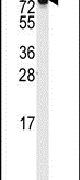DLG7 Antibody in Western Blot (WB)