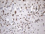 DLX1 Antibody in Immunohistochemistry (Paraffin) (IHC (P))