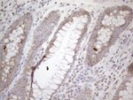 DLX4 Antibody in Immunohistochemistry (Paraffin) (IHC (P))