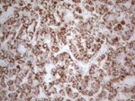 DLX4 Antibody in Immunohistochemistry (Paraffin) (IHC (P))