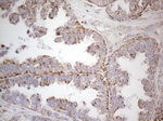 DLX4 Antibody in Immunohistochemistry (Paraffin) (IHC (P))