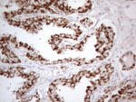DLX4 Antibody in Immunohistochemistry (Paraffin) (IHC (P))
