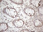 DLX4 Antibody in Immunohistochemistry (Paraffin) (IHC (P))