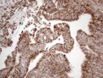 DLX4 Antibody in Immunohistochemistry (Paraffin) (IHC (P))